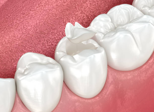 Oral Surgery in Holmen, WI